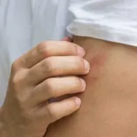Close up of a person scratching their arm against a pink background.