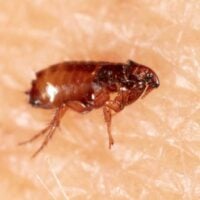 Flea on human skin
